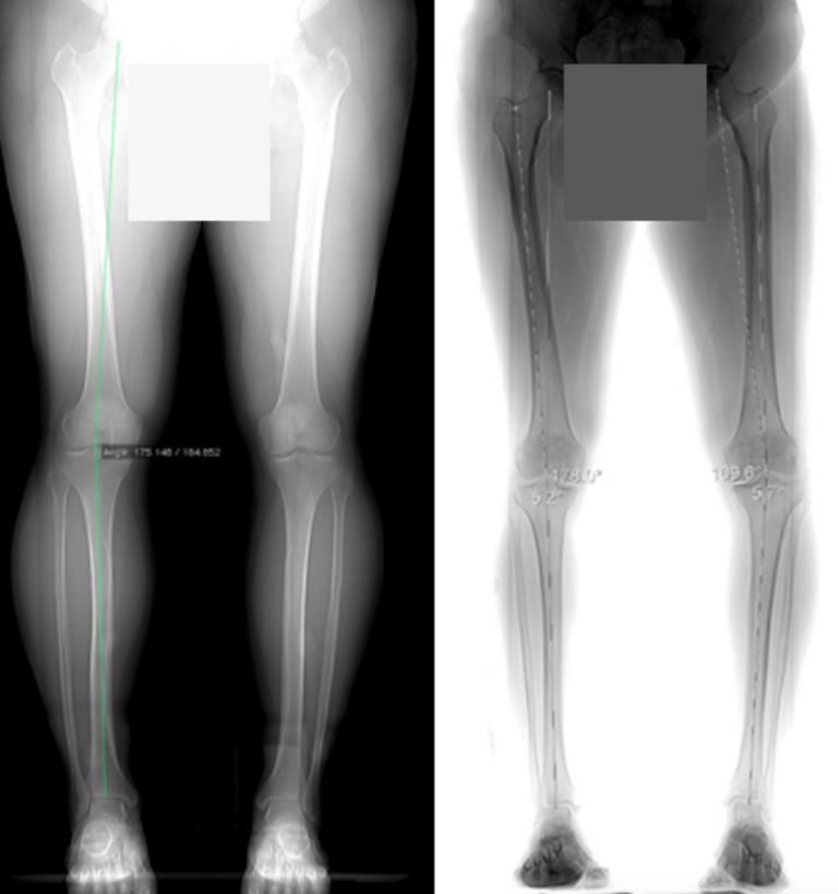 Knie - Internationales Zentrum für Orthopädie - ATOS Klinik Heidelberg