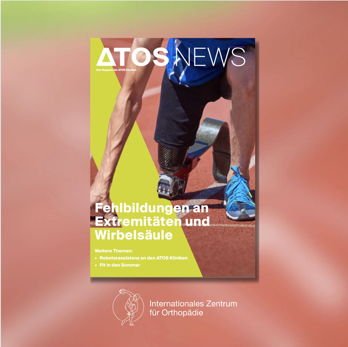 “Fehlbildungen an Extemitäten und Wirbelsäule” – das neue ATOS News Magazin ist da!
